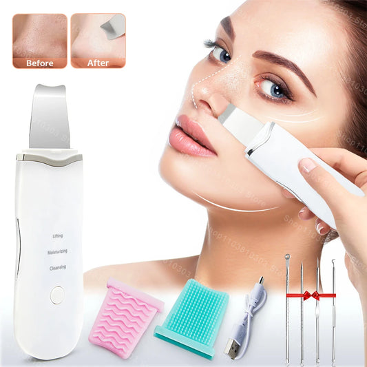 Espátula Ultrasónica Facial - Extracción de Impurezas Suave - Renueva tu piel desde el primer uso