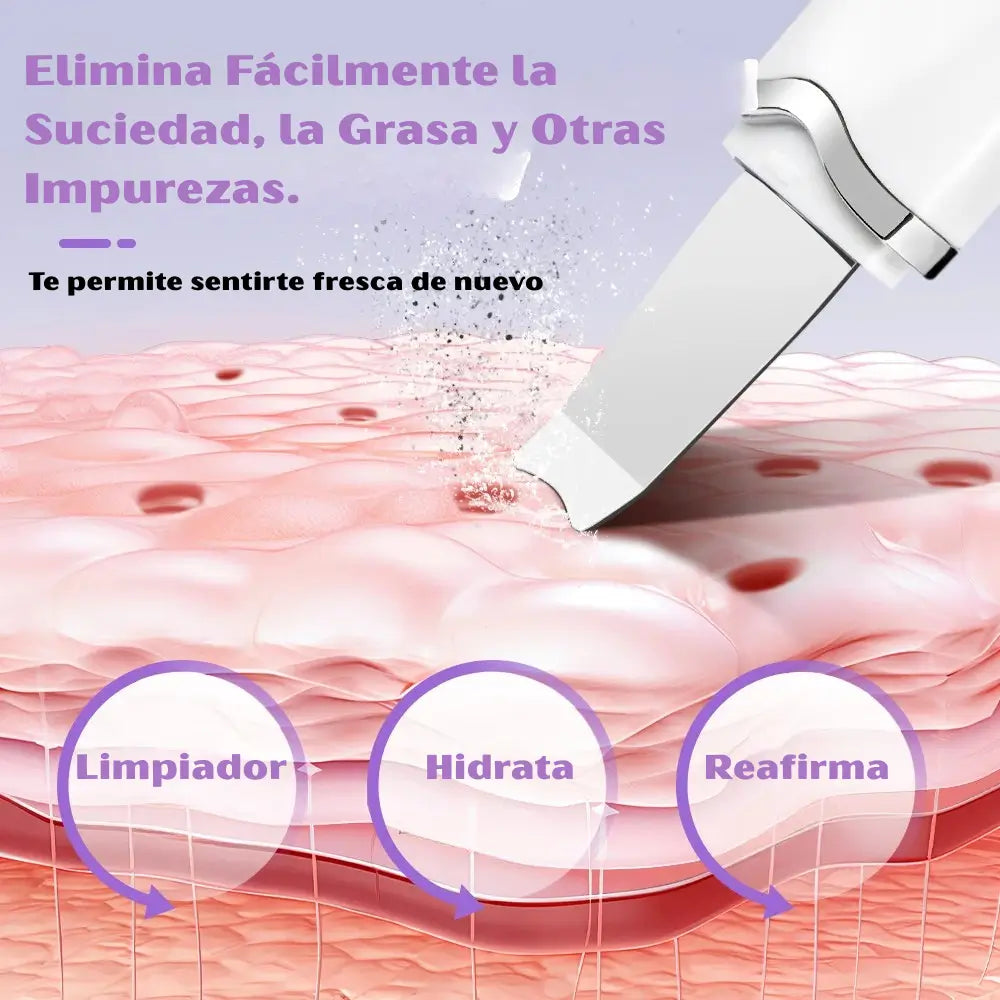 Espátula Ultrasónica Facial - Extracción de Impurezas Suave - Renueva tu piel desde el primer uso